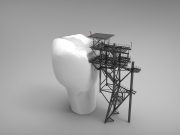 Ce să faci când iți spargi un dinte? Stomatologie sector 6